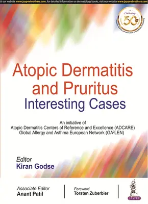 Dermatitis atópica y prurito - Atopic Dermatitis and Pruritus