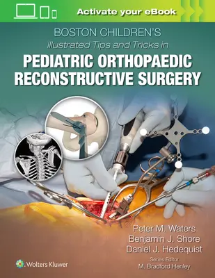 Consejos y trucos ilustrados de Boston Children's en cirugía reconstructiva ortopédica pediátrica - Boston Children's Illustrated Tips and Tricks in Pediatric Orthopaedic Reconstructive Surgery