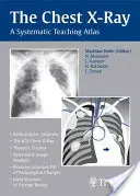 La radiografía de tórax: Atlas de Enseñanza Sistemática - The Chest X-Ray: A Systematic Teaching Atlas