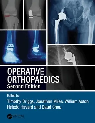 Ortopedia Operatoria - Operative Orthopaedics