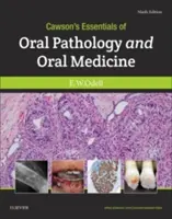 Cawson's Essentials of Oral Pathology and Oral Medicine (Fundamentos de patología oral y medicina oral de Cawson) - Cawson's Essentials of Oral Pathology and Oral Medicine