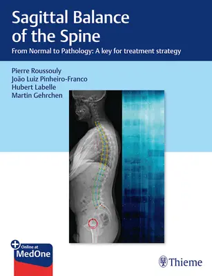 Equilibrio sagital de la columna vertebral: De la Normalidad a la Patología: Una clave para la estrategia de tratamiento - Sagittal Balance of the Spine: From Normal to Pathology: A Key for Treatment Strategy