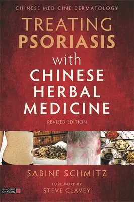 Treating Psoriasis with Chinese Herbal Medicine (Revised Edition): Manual práctico - Treating Psoriasis with Chinese Herbal Medicine (Revised Edition): A Practical Handbook