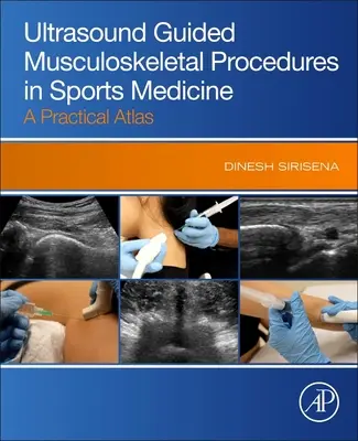 Procedimientos musculoesqueléticos guiados por ecografía en medicina deportiva - Atlas práctico - Ultrasound Guided Musculoskeletal Procedures in Sports Medicine - A Practical Atlas