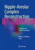 Reconstrucción del complejo areola-pezón: Principios y técnicas clínicas - Nipple-Areolar Complex Reconstruction: Principles and Clinical Techniques