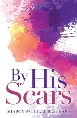 Por sus cicatrices - By His Scars