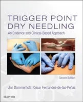 Punción seca en puntos gatillo: Un enfoque basado en la evidencia y la clínica - Trigger Point Dry Needling: An Evidence and Clinical-Based Approach