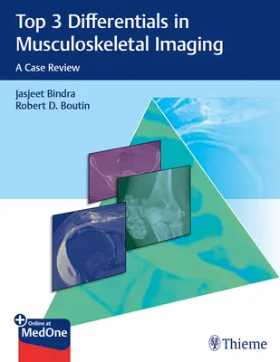 Las 3 principales diferencias en el diagnóstico por imagen musculoesquelético: Revisión de casos - Top 3 Differentials in Musculoskeletal Imaging: A Case Review