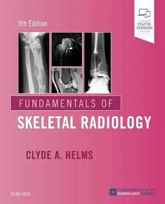 Fundamentos de radiología esquelética - Fundamentals of Skeletal Radiology