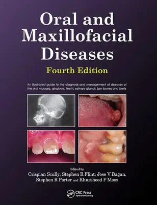 Enfermedades orales y maxilofaciales, cuarta edición - Oral and Maxillofacial Diseases, Fourth Edition