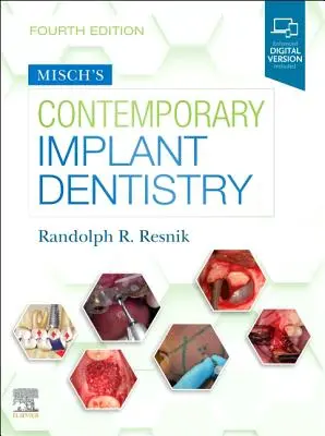 Implantología contemporánea de Misch - Misch's Contemporary Implant Dentistry