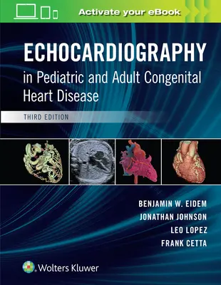 La ecocardiografía en las cardiopatías congénitas pediátricas y del adulto - Echocardiography in Pediatric and Adult Congenital Heart Disease