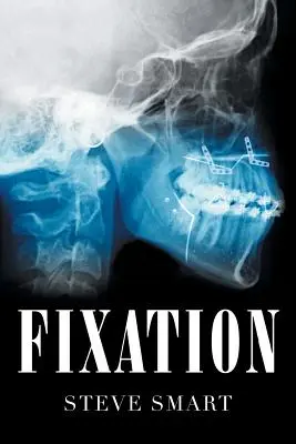 Fijación - Fixation