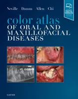 Atlas en color de las enfermedades orales y maxilofaciales - Color Atlas of Oral and Maxillofacial Diseases