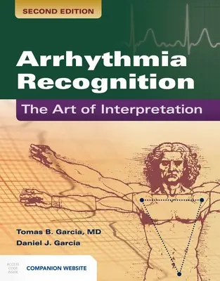 Reconocimiento de Arritmias: El Arte de la Interpretación: El Arte de la Interpretación - Arrhythmia Recognition: The Art of Interpretation: The Art of Interpretation