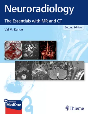 Neurorradiología: Lo esencial con RM y TC - Neuroradiology: The Essentials with MR and CT