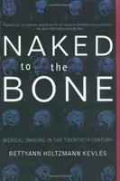 Desnudo hasta los huesos: la imagen médica en el siglo XX - Naked to the Bone: Medical Imaging in the Twentieth Century