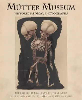 Fotografías médicas históricas del Museo Mtter - Mtter Museum Historic Medical Photographs
