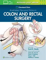 Consejos y Trucos Ilustrados de la Clínica Cleveland en Cirugía de Colon y Recto - Cleveland Clinic Illustrated Tips and Tricks in Colon and Rectal Surgery