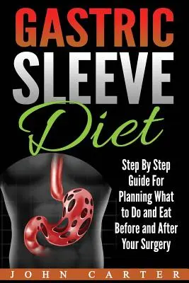 Dieta de Manga Gástrica: Guía paso a paso para planificar qué hacer y comer antes y después de la cirugía - Gastric Sleeve Diet: Step By Step Guide For Planning What to Do and Eat Before and After Your Surgery