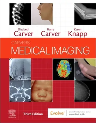 Imágenes médicas de Carvers - Carvers' Medical Imaging