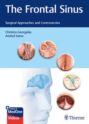 El seno frontal: Abordajes quirúrgicos y controversias - The Frontal Sinus: Surgical Approaches and Controversies