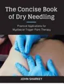 Libro conciso de la técnica de la aguja seca - Guía del profesional para la aplicación de los puntos gatillo miofasciales - Concise Book of Dry Needling - A Practitioner's Guide to Myofascial Trigger Point Applications