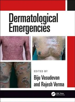 Urgencias dermatológicas - Dermatological Emergencies