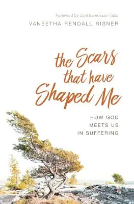 Las cicatrices que me han formado: Cómo Dios nos encuentra en el sufrimiento - The Scars That Have Shaped Me: How God Meets Us in Suffering