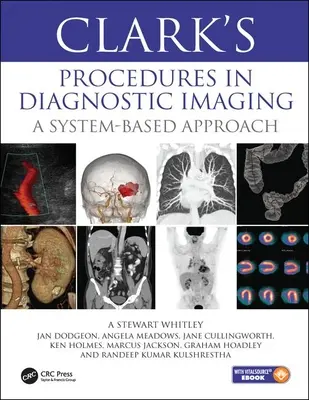 Procedimientos de Clark en el diagnóstico por imagen - Un enfoque basado en sistemas - Clark's Procedures in Diagnostic Imaging - A System-Based Approach