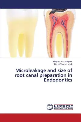 Microfugas y tamaño de la preparación del conducto radicular en Endodoncia - Microleakage and size of root canal preparation in Endodontics