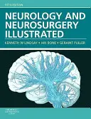 Neurología y Neurocirugía Ilustradas - Neurology and Neurosurgery Illustrated