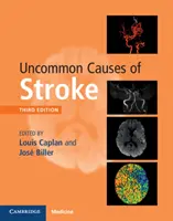 Causas poco frecuentes de ictus - Uncommon Causes of Stroke