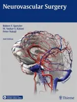 Cirugía Neurovascular - Neurovascular Surgery