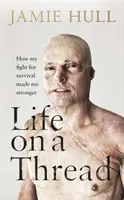La vida en un hilo - Cómo mi lucha por la supervivencia me hizo más fuerte - Life on a Thread - How my fight for survival made me stronger