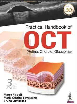 Manual práctico de OCT - (Retina, coroides, glaucoma) - Practical Handbook of OCT - (Retina, Choroid, Glaucoma)