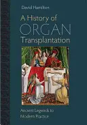 Historia del trasplante de órganos: De las leyendas antiguas a la práctica moderna - A History of Organ Transplantation: Ancient Legends to Modern Practice