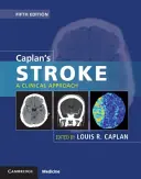 Ictus de Caplan: Un enfoque clínico - Caplan's Stroke: A Clinical Approach