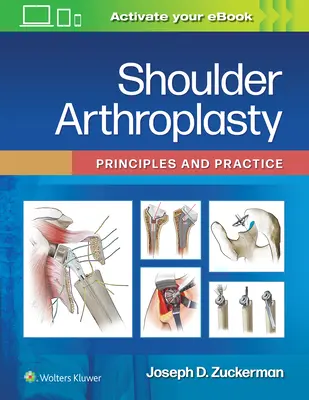 Artroplastia de hombro: Principios y práctica - Shoulder Arthroplasty: Principles and Practice