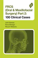 Frcs (Cirugía Oral y Maxilofacial) Parte 2: 100 Casos Clínicos - Frcs (Oral & Maxillofacial Surgery) Part 2: 100 Clinical Cases