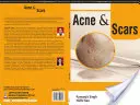 ACNÉ y ESCARAS - ACNE and SCARS