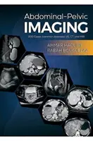 Imagenología Abdomino-Pélvica - 200 Casos (Enfermedades Comunes): US, CT y MRI - Abdominal-Pelvic Imaging - 200 Cases (Common Diseases): US, CT and MRI