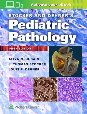 Patología pediátrica de Stocker y Dehner - Stocker and Dehner's Pediatric Pathology