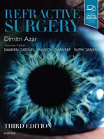 Cirugía refractiva - Refractive Surgery