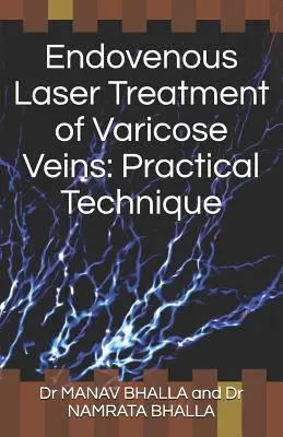 Tratamiento con láser endovenoso de las varices: Técnica práctica - Endovenous Laser Treatment of Varicose Veins: Practical Technique