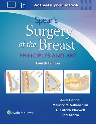 Spear's Surgery of the Breast: Principios y arte - Spear's Surgery of the Breast: Principles and Art