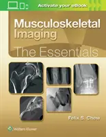 Muskuloskelettale Bildgebung: Das Wesentliche - Musculoskeletal Imaging: The Essentials