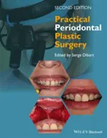 Cirugía plástica periodontal práctica - Practical Periodontal Plastic Surgery