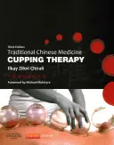 Terapia de ventosas de la medicina tradicional china - Traditional Chinese Medicine Cupping Therapy