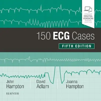 150 casos de ECG - 150 ECG Cases